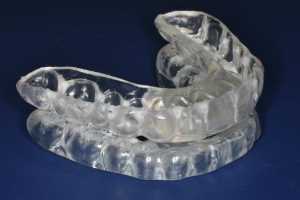 oral appliance for tmj