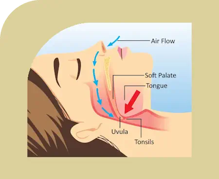 diagram showing closed airway for breathing